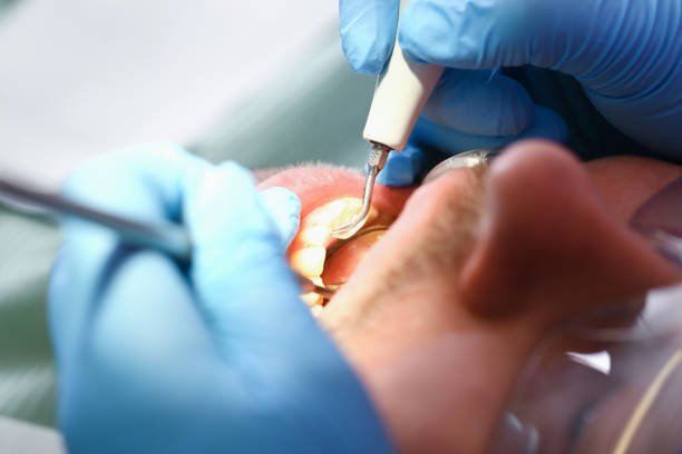Best Emergency Broken Tooth Repair in Ama, LA