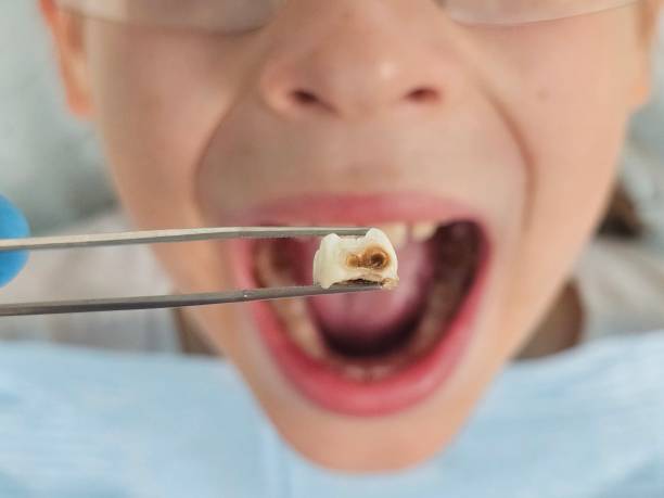 Best 24-Hour Emergency Dentist in Ama, LA